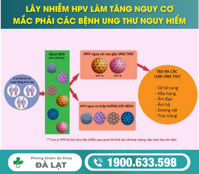 Hình ảnh minh họa